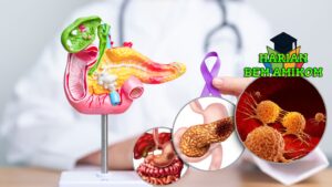 Gejala Kanker Pankreas Lewat Perubahan Feses